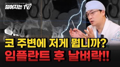 임플란트 수술 후 축농증 부작용이 발생하는 이유